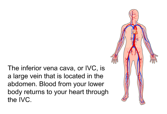 The inferior vena cava, or IVC, is a large vein that is located in the abdomen. Blood from your lower body returns to your heart through the IVC.