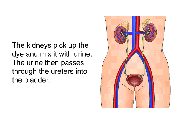The kidneys pick up the dye and mix it with urine. The urine then passes through the ureters into the bladder.