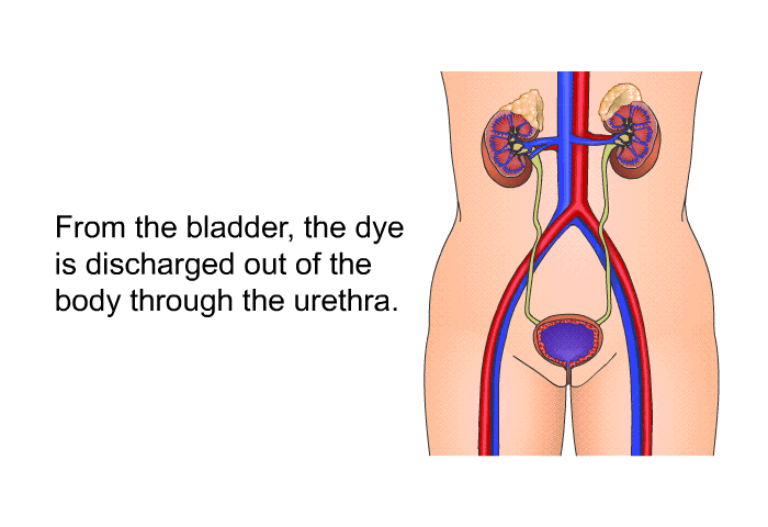 From the bladder, the dye is discharged out of the body through the urethra.