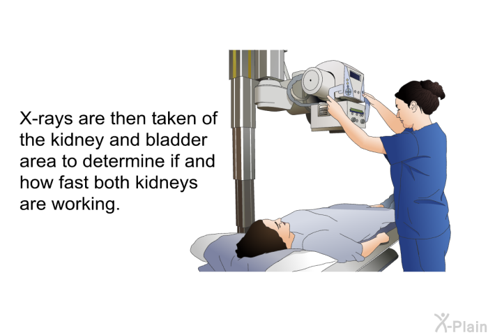 X-rays are then taken of the kidney and bladder area to determine if and how fast both kidneys are working.