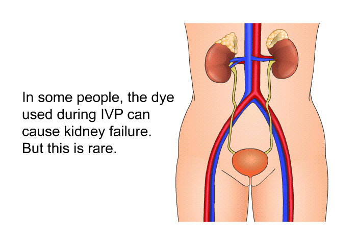 In some people, the dye used during IVP can cause kidney failure. But this is rare.
