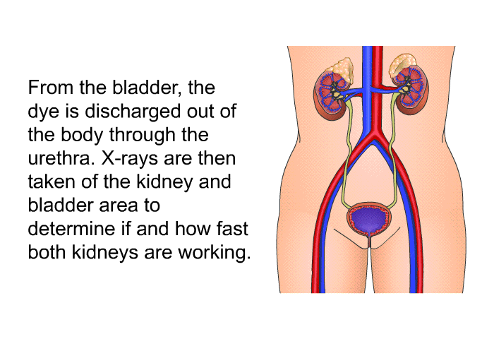 From the bladder, the dye is discharged out of the body through the urethra. X-rays are then taken of the kidney and bladder area to determine if and how fast both kidneys are working.