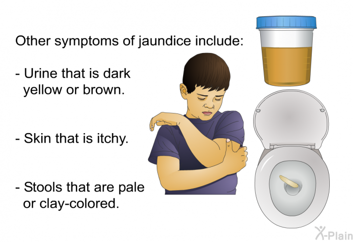 Other symptoms of jaundice include:  Urine that is dark yellow or brown. Skin that is itchy. Stools that are pale or clay-colored.