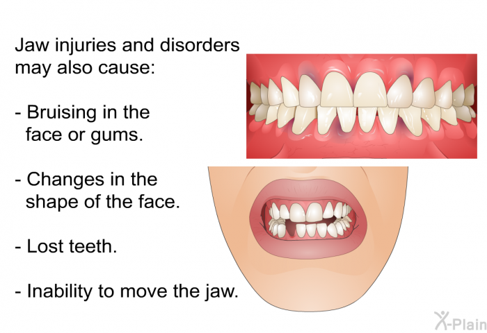 Jaw injuries and disorders may also cause:  Bruising in the face or gums. Changes in the shape of the face. Lost teeth. Inability to move the jaw.