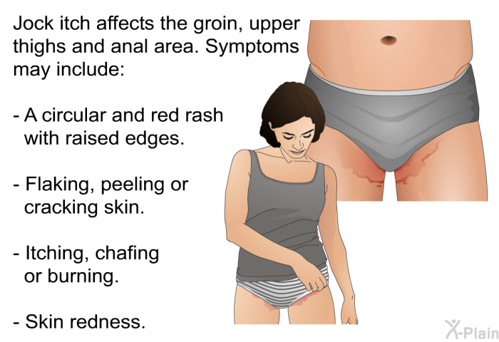 Jock itch affects the groin, upper thighs and anal area. Symptoms may include:  A circular and red rash with raised edges. Flaking, peeling or cracking skin. Itching, chafing or burning. Skin redness.