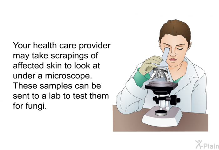 Your health care provider may take scrapings of affected skin to look at under a microscope. These samples can be sent to a lab to test them for fungi.