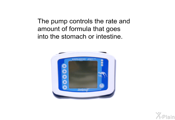 The pump controls the rate and amount of formula that goes into the stomach or intestine.