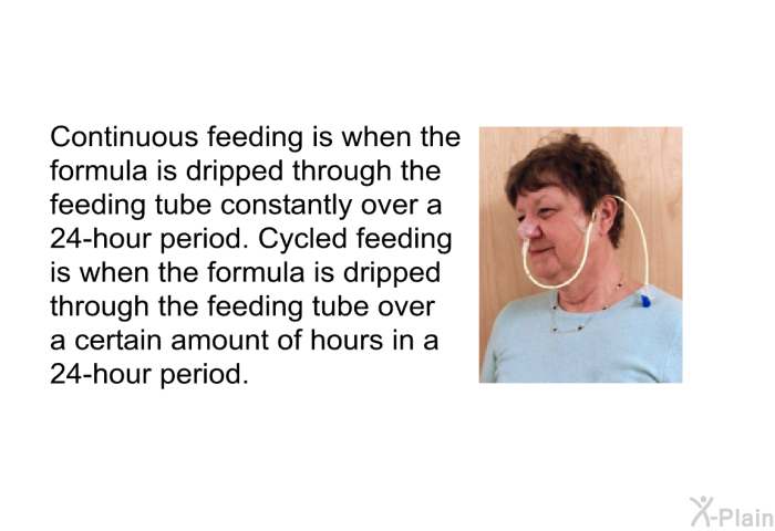 Continuous feeding is when the formula is dripped through the feeding tube constantly over a 24-hour period. Cycled feeding is when the formula is dripped through the feeding tube over a certain amount of hours in a 24-hour period.