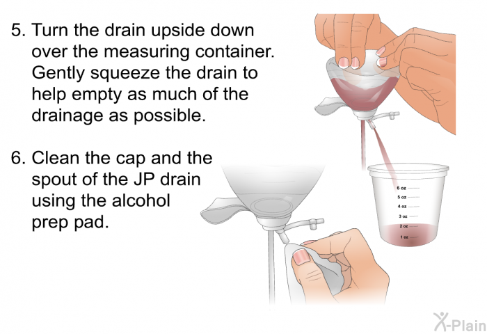 Turn the drain upside down over the measuring container. Gently squeeze the drain to help empty as much of the drainage as possible. Clean the cap and the spout of the JP drain using the alcohol prep pad.