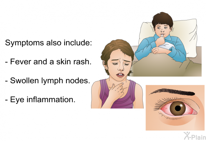 Symptoms also include:  Fever and a skin rash. Swollen lymph nodes. Eye inflammation.