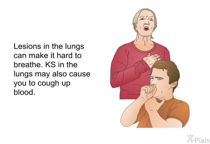 Lesions in the lungs can make it hard to breathe. KS in the lungs may also cause you to cough up blood.