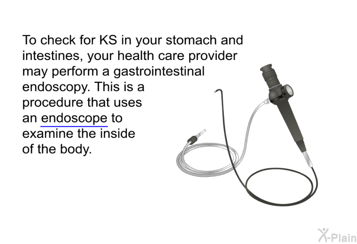 To check for KS in your stomach and intestines, your health care provider may perform a gastrointestinal endoscopy. This is a procedure that uses an endoscope to examine the inside of the body.