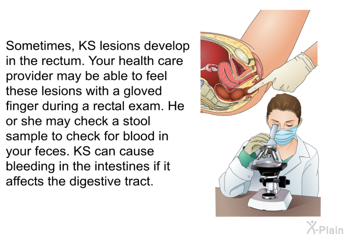 Sometimes, KS lesions develop in the rectum. Your health care provider may be able to feel these lesions with a gloved finger during a rectal exam. He or she may check a stool sample to check for blood in your feces. KS can cause bleeding in the intestines if it affects the digestive tract.