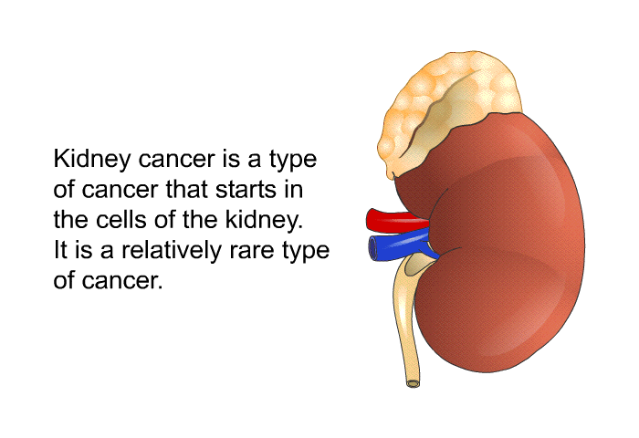Kidney cancer is a type of cancer that starts in the cells of the kidney. It is a relatively rare type of cancer.