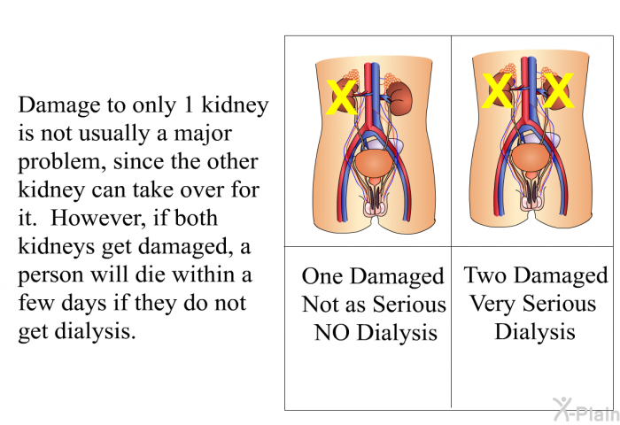 Damage to only 1 kidney is not usually a major problem, since the other kidney can take over for it. However, if both kidneys get damaged, a person will die within a few days if they do not get dialysis.