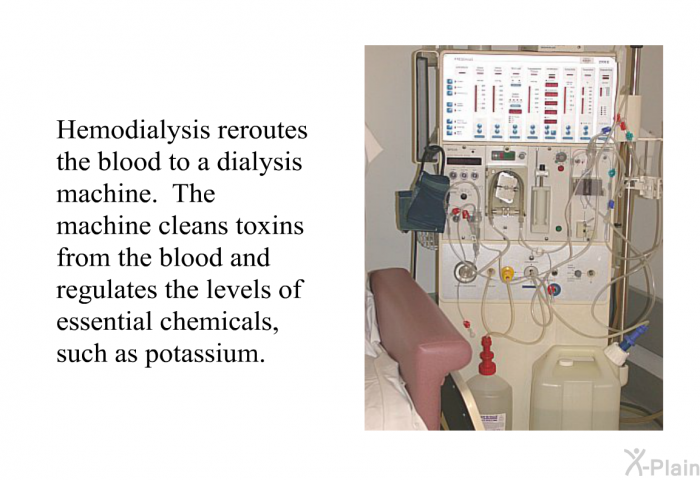 Hemodialysis reroutes the blood to a dialysis machine. The machine cleans toxins from the blood and regulates the levels of essential chemicals, such as potassium.