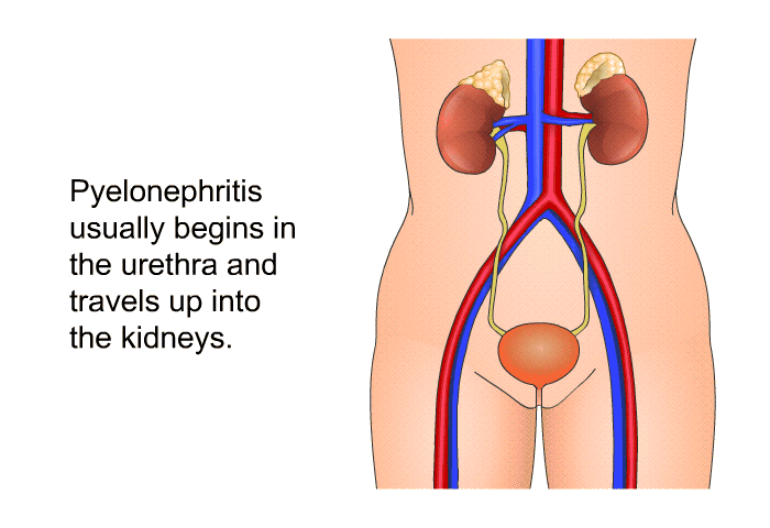 Pyelonephritis usually begins in the urethra and travels up into the kidneys.