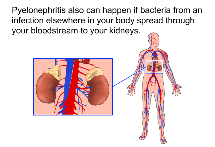 Pyelonephritis also can happen if bacteria from an infection elsewhere in your body spread through your bloodstream to your kidneys.