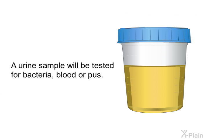 A urine sample will be tested for bacteria, blood or pus.