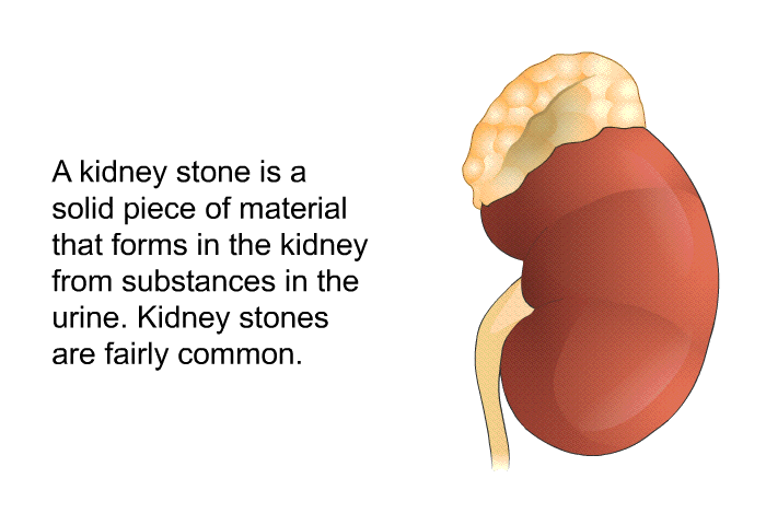 A kidney stone is a solid piece of material that forms in the kidney from substances in the urine. Kidney stones are fairly common.