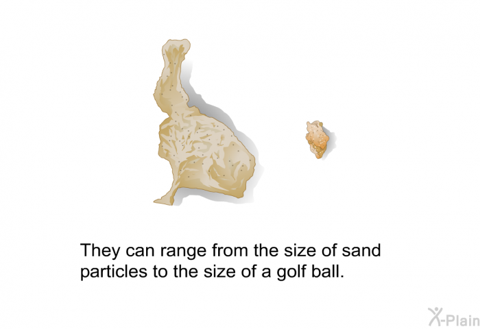 They can range from the size of sand particles to the size of a golf ball.
