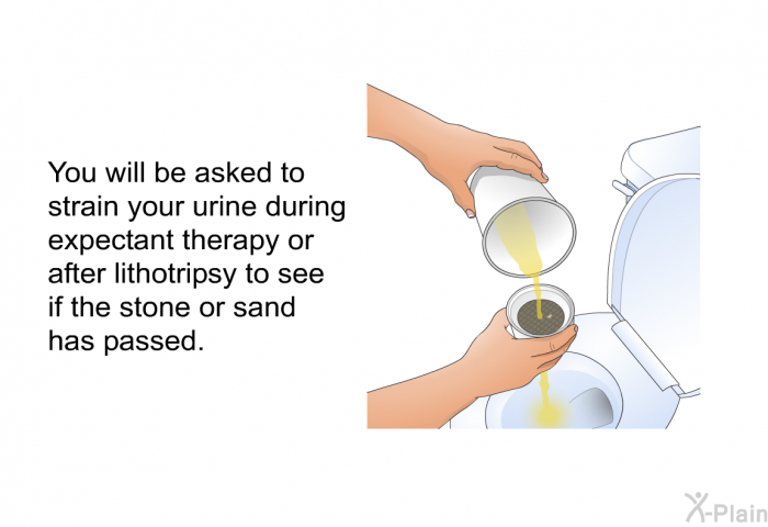 You will be asked to strain your urine during expectant therapy or after lithotripsy to see if the stone or sand has passed.