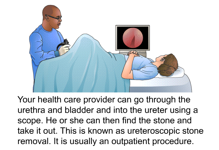 Your health care provider can go through the urethra and bladder and into the ureter using a scope. He or she can then find the stone and take it out. This is known as ureteroscopic stone removal. It is usually an outpatient procedure.