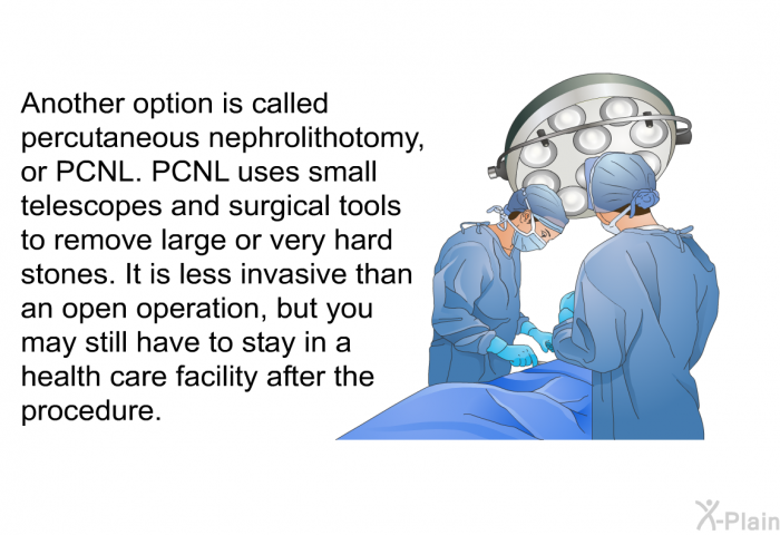 Another option is called percutaneous nephrolithotomy, or PCNL. PCNL uses small telescopes and surgical tools to remove large or very hard stones. It is less invasive than an open operation, but you may still have to stay in a health care facility after the procedure.