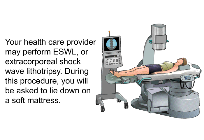 Your health care provider may perform ESWL, or extracorporeal shock wave lithotripsy. During this procedure, you will be asked to lie down on a soft mattress.