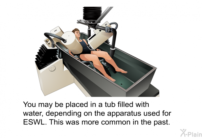 You may be placed in a tub filled with water, depending on the apparatus used for ESWL. This was more common in the past.