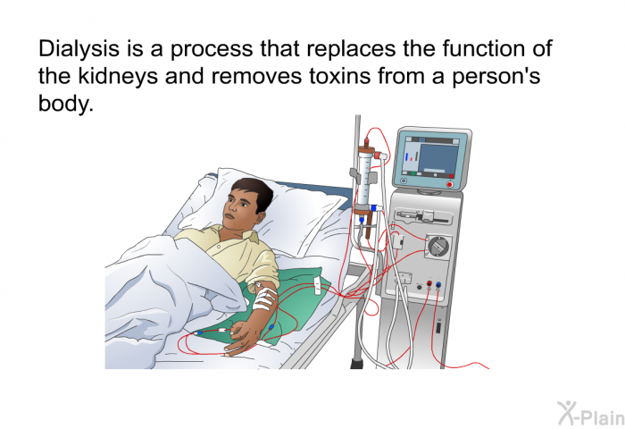 Dialysis is a process that replaces the function of the kidneys and removes toxins from a person's body.
