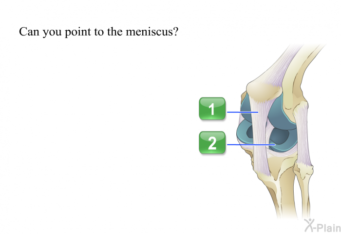 Can you point to the meniscus? Press A or B