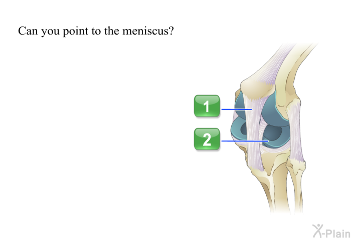 Can you point to the meniscus? Press A or B