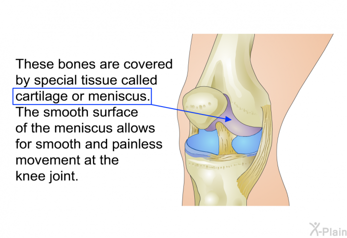 These bones are covered by special tissue called cartilage or meniscus. The smooth surface of the meniscus allows for smooth and painless movement at the knee joint.