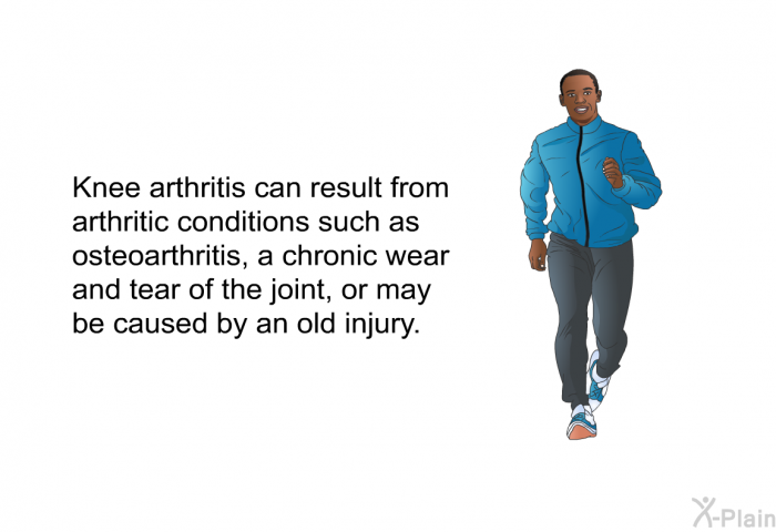 Knee arthritis can result from arthritic conditions such as osteoarthritis, a chronic wear and tear of the joint, or may be caused by an old injury.