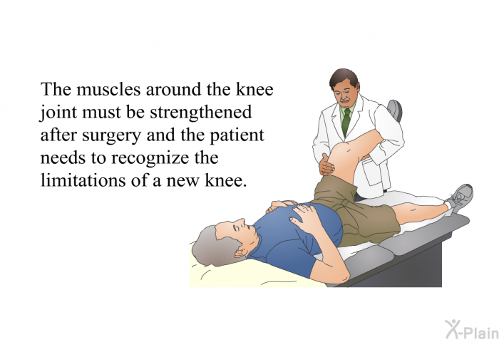 The muscles around the knee joint must be strengthened after surgery and the patient needs to recognize the limitations of a new knee.