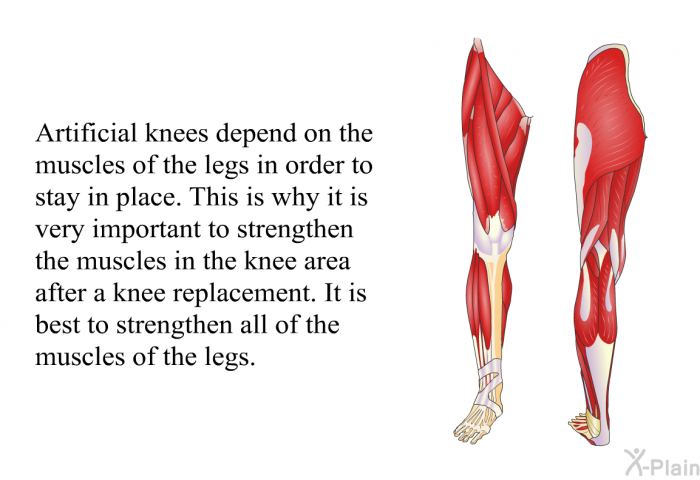 Artificial knees depend on the muscles of the legs in order to stay in place. This is why it is very important to strengthen the muscles in the knee area after a knee replacement. It is best to strengthen all of the muscles of the legs.