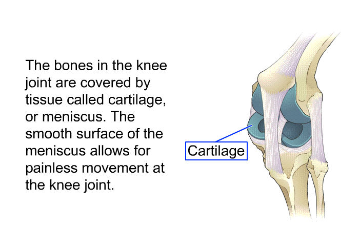 The bones in the knee joint are covered by tissue called cartilage, or meniscus. The smooth surface of the meniscus allows for painless movement at the knee joint.