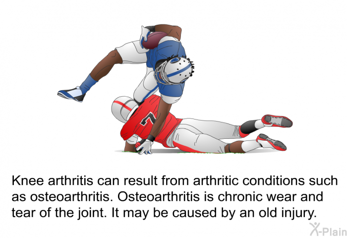 Knee arthritis can result from arthritic conditions such as osteoarthritis. Osteoarthritis is chronic wear and tear of the joint. It may be caused by an old injury.
