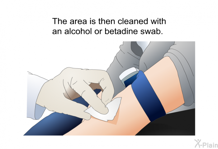 The area is then cleaned with an alcohol or betadine swab.