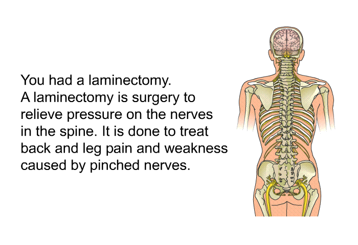 You had a laminectomy. A laminectomy is surgery to relieve pressure on the nerves in the spine. It is done to treat back and leg pain and weakness caused by pinched nerves.