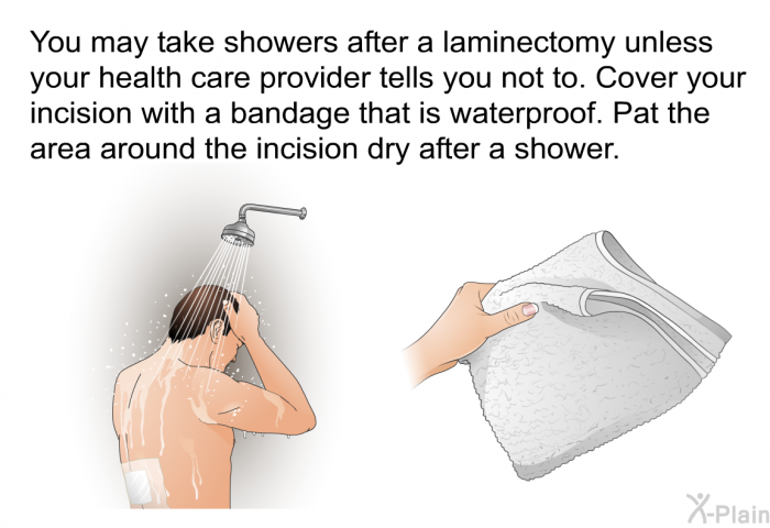 You may take showers after a laminectomy unless your health care provider tells you not to. Cover your incision with a bandage that is waterproof. Pat the area around the incision dry after a shower.