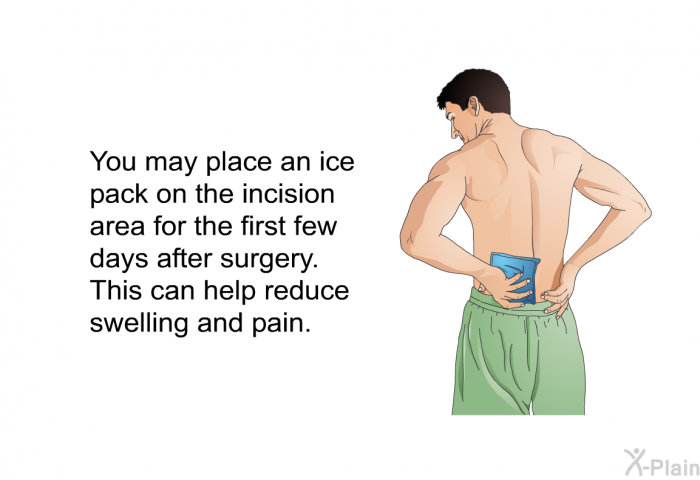 You may place an ice pack on the incision area for the first few days after surgery. This can help reduce swelling and pain.