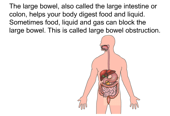 The large bowel, also called the large intestine or colon, helps your body digest food and liquid. Sometimes food, liquid and gas can block the large bowel. This is called large bowel obstruction.