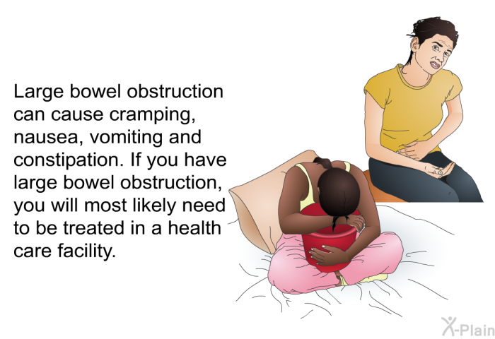 Large bowel obstruction can cause cramping, nausea, vomiting and constipation. If you have large bowel obstruction, you will most likely need to be treated in a health care facility.
