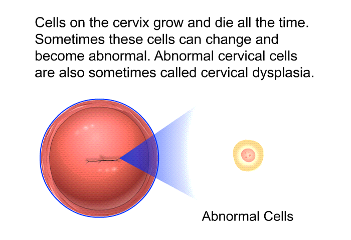 Cells on the cervix grow and die all the time. Sometimes these cells can change and become abnormal. Abnormal cervical cells are also sometimes called cervical dysplasia.