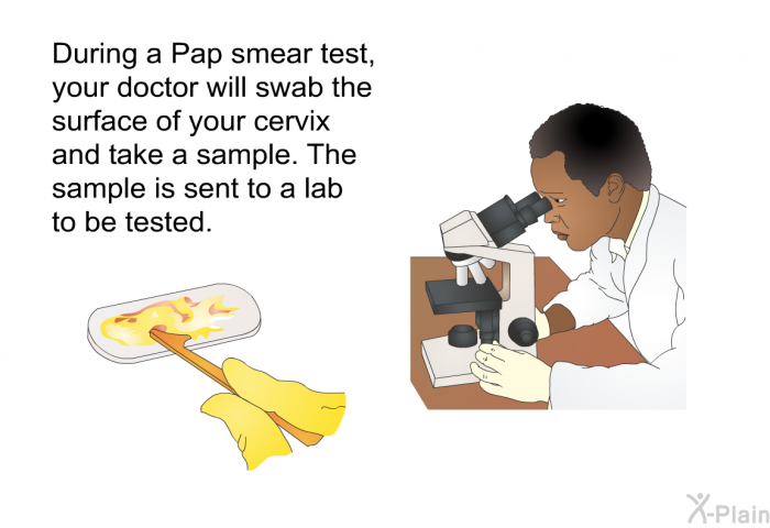 During a Pap smear test, your doctor will swab the surface of your cervix and take a sample. The sample is sent to a lab to be tested.