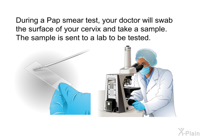 During a Pap smear test, your doctor will swab the surface of your cervix and take a sample. The sample is sent to a lab to be tested.