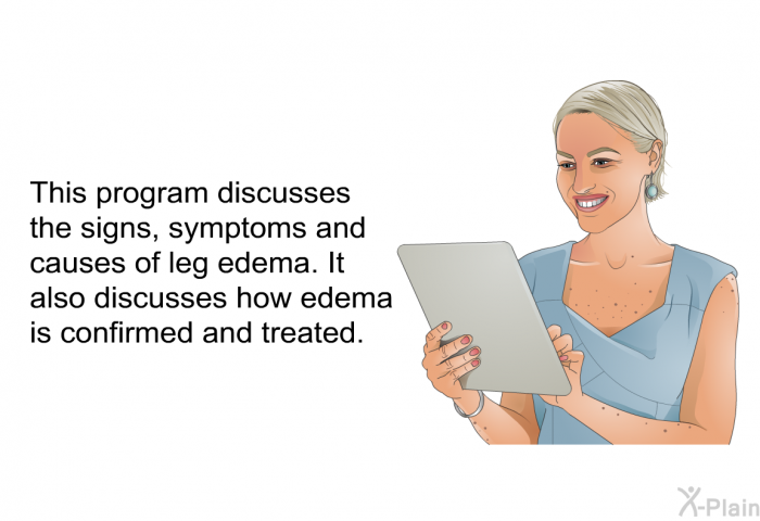 This health information discusses the signs, symptoms and causes of leg edema. It also discusses how edema is confirmed and treated.