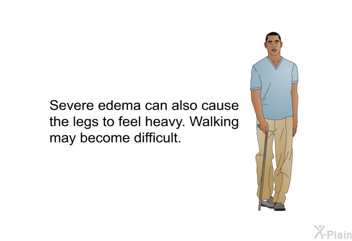 Severe edema can also cause the legs to feel heavy. Walking may become difficult.